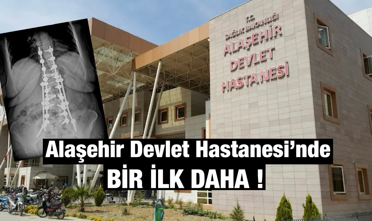 Alaşehir Devlet Hastanesi&rsquo;nde Bir İlk: Skolyoz Ameliyatı Başarıyla Yapıldı